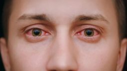 Болезни глаза и его вспомогательных органов